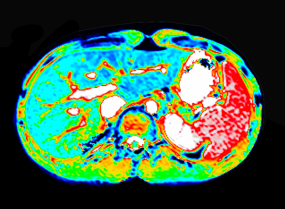 Liver imaging