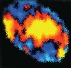 Oxygen-enhanced MRI detects incidence, onset and heterogeneity of radiation-induced hypoxia modification in HPV-associated oropharyngeal cancer